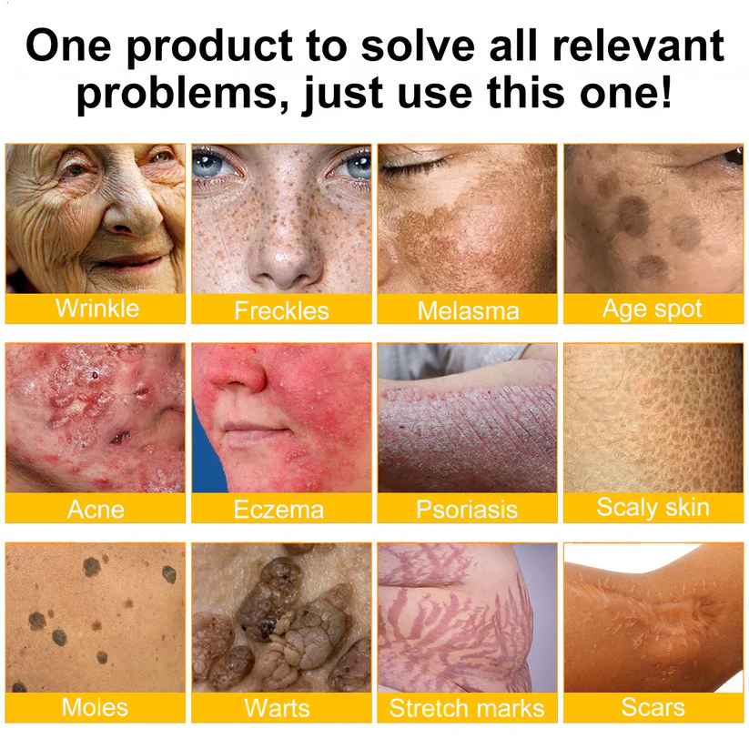 💥💥TGA Approved: Ourlyard® Bee venom Pro Comprehensive Cream — 🔥Limited Time 80% OFF🔥