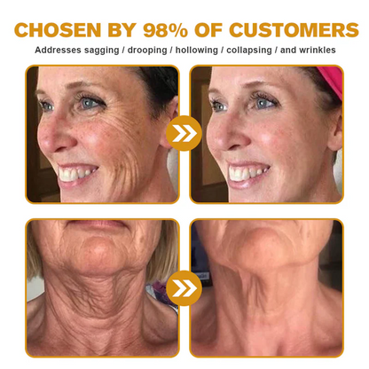 💥💥TGA Approved: Ourlyard® Bee venom Pro Comprehensive Cream — 🔥Limited Time 80% OFF🔥
