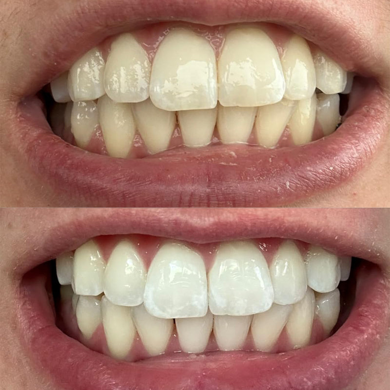 💧Smileasego™ Whitening Remineralizing Tooth Powder, Fluoride Free, Teeth Polish & Stain Remover
