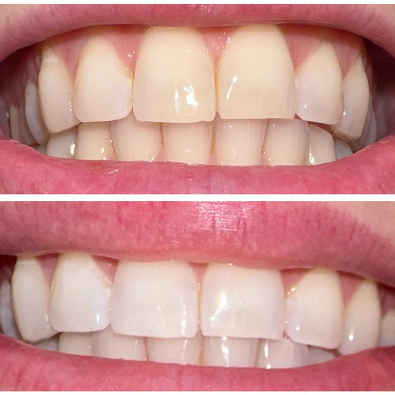 💧Smileasego™ Whitening Remineralizing Tooth Powder, Fluoride Free, Teeth Polish & Stain Remover