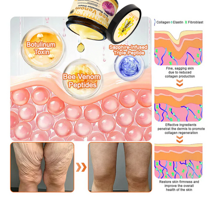 💥💥TGA Approved: Ourlyard® Bee venom Pro Comprehensive Cream — 🔥Limited Time 80% OFF🔥